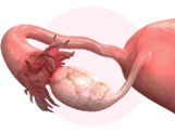 FALLOPIAN TUBES