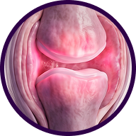 Inflammation