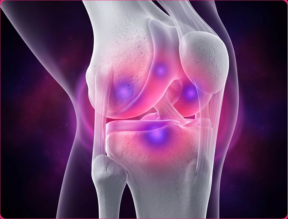 Medical illustration of a knee joint with the painful areas glowing