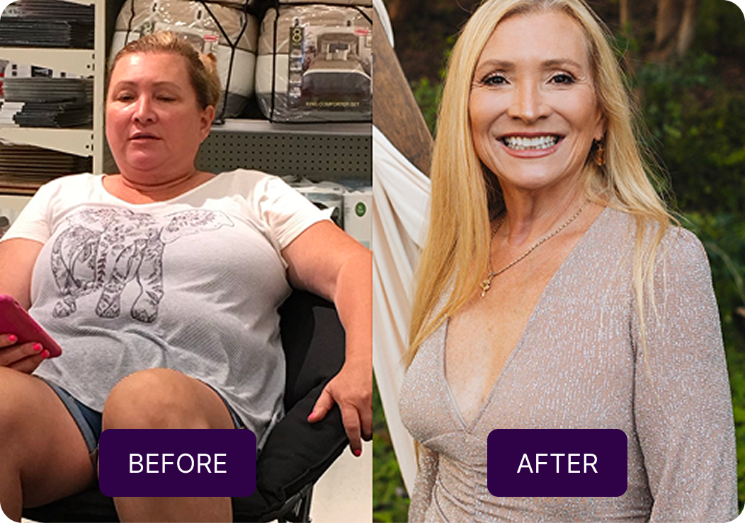 Autoscroll Comparative