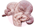UTERUS