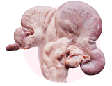 UTERO