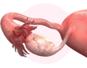 FALLOPIAN TUBES